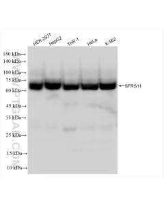 SFRS11 Recombinant monoclonal antibody proteintech 83605-6-RR