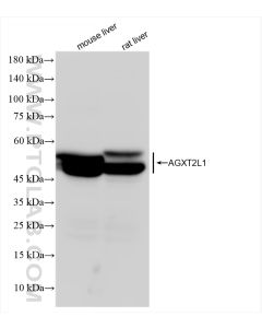 AGXT2L1 Recombinant monoclonal antibody proteintech 83984-6-RR