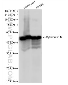 Cytokeratin 14 Recombinant monoclonal antibody proteintech 83379-1-RR