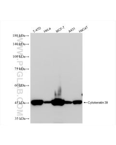 Cytokeratin 39 Recombinant monoclonal antibody proteintech 86277-2-RR