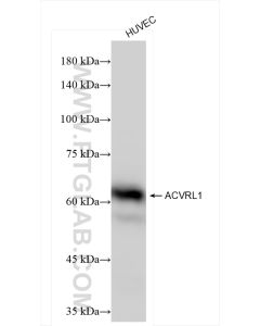 ACVRL1 Recombinant monoclonal antibody proteintech 84421-3-RR