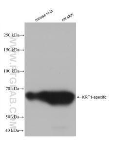 Cytokeratin 1-specific Recombinant monoclonal antibody proteintech 82972-1-RR