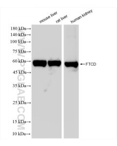 FTCD Recombinant monoclonal antibody proteintech 83664-2-RR