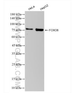 FOXO6 Recombinant monoclonal antibody proteintech 83926-1-RR
