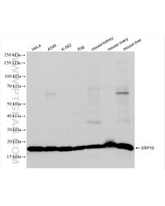 SRP19 Recombinant monoclonal antibody proteintech 84061-3-RR