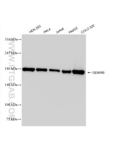 GEMIN5 Recombinant monoclonal antibody proteintech 84171-5-RR