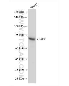 AFP Recombinant monoclonal antibody proteintech 82982-5-RR