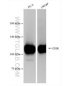 DPP4/CD26 Recombinant monoclonal antibody proteintech 84606-6-RR
