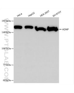 ADNP Recombinant monoclonal antibody proteintech 85054-2-RR