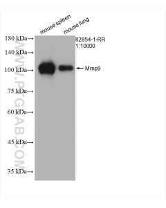Mmp9 Recombinant monoclonal antibody proteintech 82854-1-RR