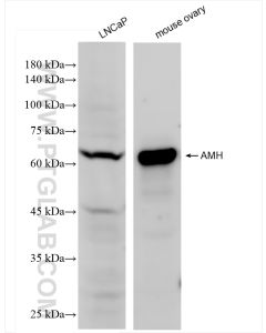 AMH Recombinant monoclonal antibody proteintech 84153-5-RR