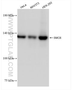 SMC6 Recombinant monoclonal antibody proteintech 83187-3-RR