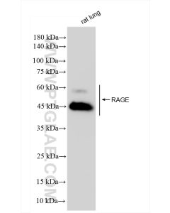 AGER/RAGE Recombinant monoclonal antibody proteintech 83759-4-RR