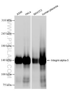 Integrin alpha-5/CD49e Recombinant monoclonal antibody proteintech 84468-4-RR