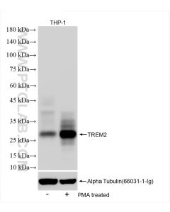 TREM2 Recombinant monoclonal antibody proteintech 83438-6-RR