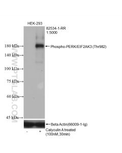 Phospho-PERK/EIF2AK3 (Thr982) Recombinant monoclonal antibody proteintech 82534-1-RR