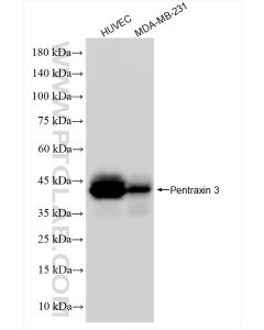 Pentraxin 3 Recombinant monoclonal antibody proteintech 84096-3-RR
