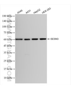 SESN3 Recombinant monoclonal antibody proteintech 84823-3-RR