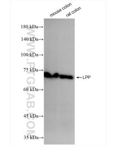 LPP Recombinant monoclonal antibody proteintech 86117-3-RR