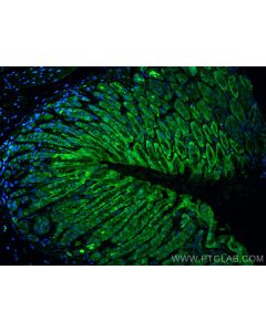 Osteopontin Recombinant monoclonal antibody proteintech 83413-6-RR