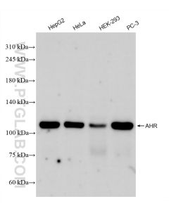 AHR Recombinant monoclonal antibody proteintech 83369-5-RR