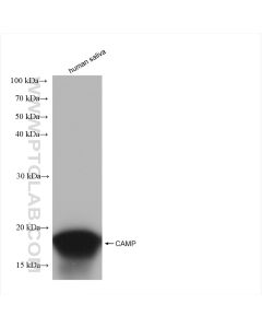 CAMP Recombinant monoclonal antibody proteintech 82940-1-RR