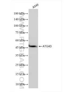 ATG4D Recombinant monoclonal antibody proteintech 83951-4-RR