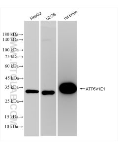 ATP6V1E1 Recombinant monoclonal antibody proteintech 83636-6-RR