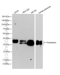 Podoplanin Recombinant monoclonal antibody proteintech 86750-2-RR