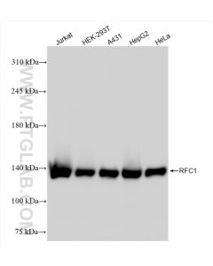 RFC1 Recombinant monoclonal antibody proteintech 85148-4-RR