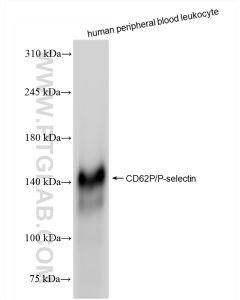 P-Selectin/CD62P Recombinant monoclonal antibody proteintech 83947-5-RR