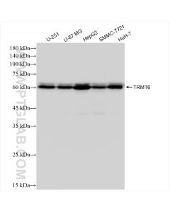 TRMT6 Recombinant monoclonal antibody proteintech 83843-5-RR