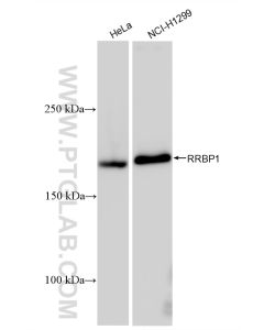 RRBP1 Recombinant monoclonal antibody proteintech 82890-3-RR