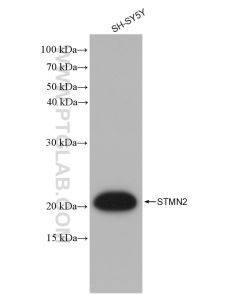 STMN2 Recombinant monoclonal antibody proteintech 82925-2-RR