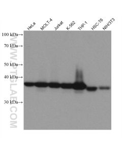 TMEM173/STING Recombinant monoclonal antibody proteintech 80165-1-RR
