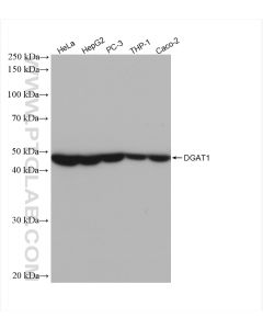 DGAT1 Recombinant monoclonal antibody proteintech 82945-1-RR