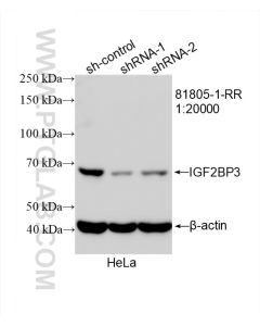 IGF2BP3 Recombinant monoclonal antibody proteintech 81805-1-RR