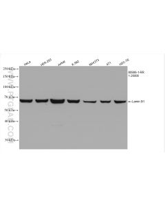 Lamin B1 Recombinant monoclonal antibody proteintech 80906-1-RR