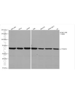 YTHDF2 Recombinant monoclonal antibody proteintech 81340-1-RR
