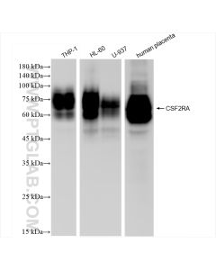 CSF2RA/CD116 Recombinant monoclonal antibody proteintech 84023-1-RR