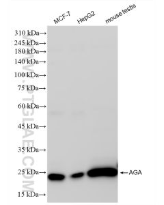 AGA Recombinant monoclonal antibody proteintech 83442-6-RR