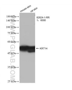 Cytokeratin 14 Recombinant monoclonal antibody proteintech 82824-1-RR