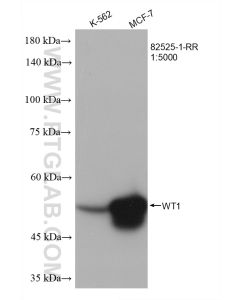 WT1 Recombinant monoclonal antibody proteintech 82525-1-RR