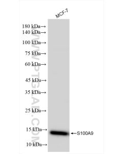 S100A9 Recombinant monoclonal antibody proteintech 83578-2-RR