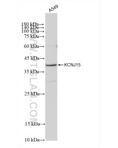 KCNJ15 Recombinant monoclonal antibody proteintech 83257-5-RR