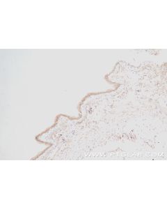 MCTS1 Recombinant monoclonal antibody proteintech 84312-5-RR