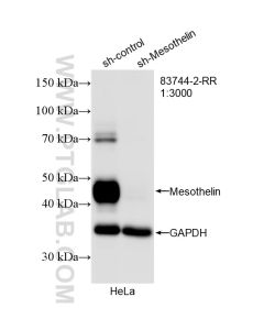 Mesothelin Recombinant monoclonal antibody proteintech 83744-2-RR