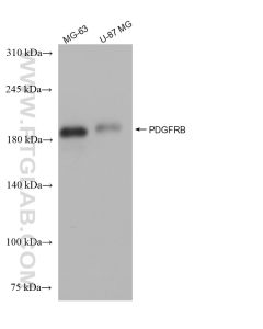 PDGFR beta/CD140b Recombinant monoclonal antibody proteintech 82943-1-RR
