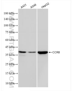 CCR8 Recombinant monoclonal antibody proteintech 84545-1-RR