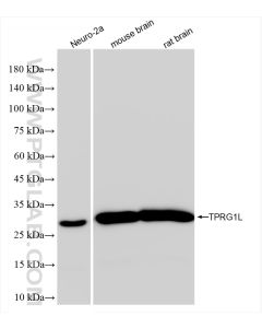 TPRG1L Recombinant monoclonal antibody proteintech 83989-4-RR